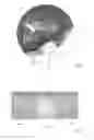 Fig. 05 - THERMAL EYE COMPRESS SYSTEMS AND METHODS OF USE