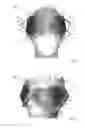 Fig. 07 - THERMAL EYE COMPRESS SYSTEMS AND METHODS OF USE