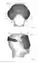 Fig. 15 - THERMAL EYE COMPRESS SYSTEMS AND METHODS OF USE