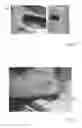 Fig. 19 - THERMAL EYE COMPRESS SYSTEMS AND METHODS OF USE