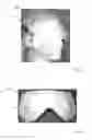Fig. 23 - THERMAL EYE COMPRESS SYSTEMS AND METHODS OF USE