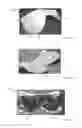 Fig. 24 - THERMAL EYE COMPRESS SYSTEMS AND METHODS OF USE