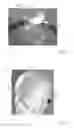 Fig. 26 - THERMAL EYE COMPRESS SYSTEMS AND METHODS OF USE