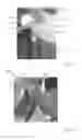 Fig. 32 - THERMAL EYE COMPRESS SYSTEMS AND METHODS OF USE