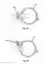 Fig. 03 - Magnetic operating microscopes and methods of treatment and diagnosis using the same