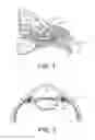 Fig. 02 - Drug delivery devices and methods