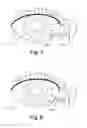 Fig. 04 - Treatment medium delivery device and methods for delivery of such treatment mediums to the eye using such delivery device