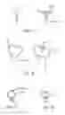 Fig. 08 - INTRAOCULAR LENS FIXATION CORRECTION METHODS AND DEVICES
