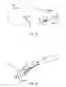 Fig. 20 - INTRAOCULAR LENS FIXATION CORRECTION METHODS AND DEVICES