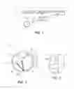 Fig. 02 - Interventional Treatments for VitreoRetinal-Interface Syndromes