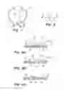 Fig. 04 - Interventional Treatments for VitreoRetinal-Interface Syndromes