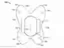 Fig. 01 - Devices and methods for treating accidental bowel leakage