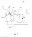 Fig. 09 - Quick release clamp for stretcher carriers and the like