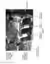 Fig. 05 - Extracorporeal life support system and methods of use thereof