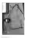 Fig. 06 - Extracorporeal life support system and methods of use thereof