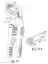 Fig. 22 - Compression device