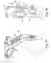 Fig. 25 - Compression device
