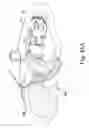 Fig. 31 - Compression device