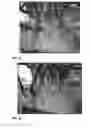 Fig. 14 - Diagnostic and treatment methods
