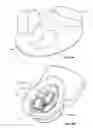 Fig. 04 - DEVICES AND METHODS FOR PROMOTING FEMALE SEXUAL WELLNESS