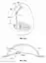 Fig. 19 - DEVICES AND METHODS FOR PROMOTING FEMALE SEXUAL WELLNESS