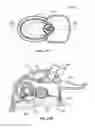 Fig. 24 - DEVICES AND METHODS FOR PROMOTING FEMALE SEXUAL WELLNESS