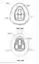 Fig. 33 - DEVICES AND METHODS FOR PROMOTING FEMALE SEXUAL WELLNESS