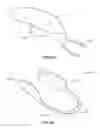 Fig. 52 - DEVICES AND METHODS FOR PROMOTING FEMALE SEXUAL WELLNESS