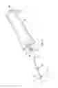 Fig. 08 - GASTROSTOMY DELIVERY SYSTEM AND METHOD
