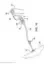 Fig. 10 - GASTROSTOMY DELIVERY SYSTEM AND METHOD