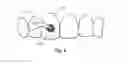 Fig. 05 - Stable dental varnish compositions and methods of manufacture and use
