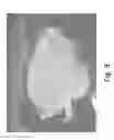 Fig. 04 - Stable silk protein fragment compositions