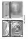 Fig. 47 - Stable silk protein fragment compositions