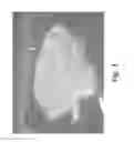 Fig. 04 - Stable silk protein fragment compositions