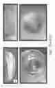 Fig. 48 - Stable silk protein fragment compositions