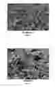 Fig. 06 - Pharmaceutical composition for parenteral administration, containing donepezil