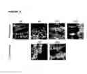 Fig. 03 - Methods of improving microvascular integrity