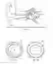 Fig. 02 - Systems and Methods for Treating Ear Disorders and Formulations Therefor