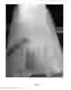 Fig. 03 - Topical medications for bruises and burns