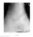 Fig. 04 - Topical medications for bruises and burns