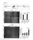 Fig. 04 - METHODS AND COMPOSITIONS FOR THE TREATMENT OF GLUTAMINE-ADDICTED CANCERS
