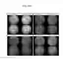 Fig. 69 - Administration of nicotinamide mononucleotide in the treatment of disease