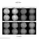 Fig. 75 - Administration of nicotinamide mononucleotide in the treatment of disease