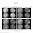 Fig. 77 - Administration of nicotinamide mononucleotide in the treatment of disease