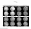 Fig. 79 - Administration of nicotinamide mononucleotide in the treatment of disease