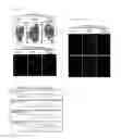 Fig. 12 - ADMINISTRATION OF ERITORAN OR PHARMACEUTICALLY ACCEPTABLE SALTS THEREOF TO TREAT ORTHOMYXOVIRUS INFECTIONS