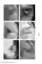 Fig. 03 - Compositions and methods of use for wound healing