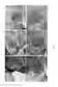 Fig. 06 - Compositions and methods of use for wound healing