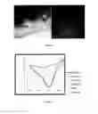 Fig. 03 - NOVEL FORMULA OF IRON BASED NANOCOMPOSITES FOR RAPID AND EFFICIENT TREATMENT OF IRON DEFICIENCY ANEMIA