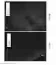 Fig. 09 - Minced Cartilage Systems and Methods